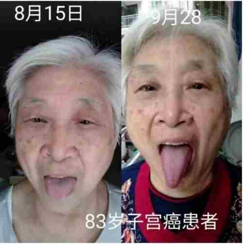 国医名师——张胜林